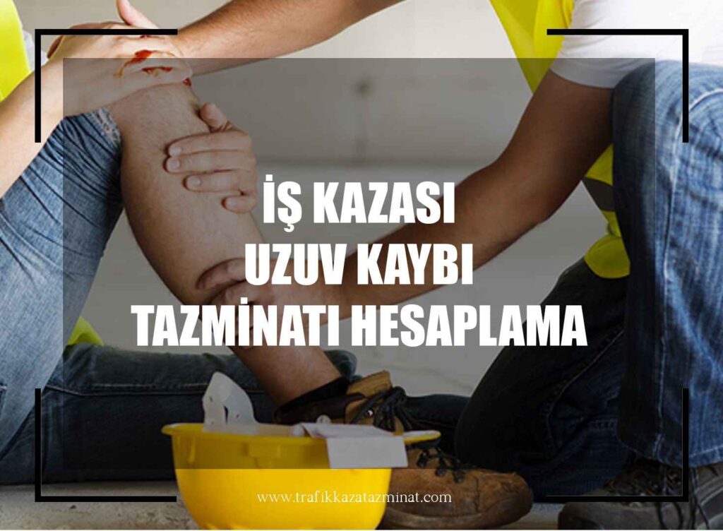İş Kazası Uzuv Kaybı Tazminatı Hesaplama